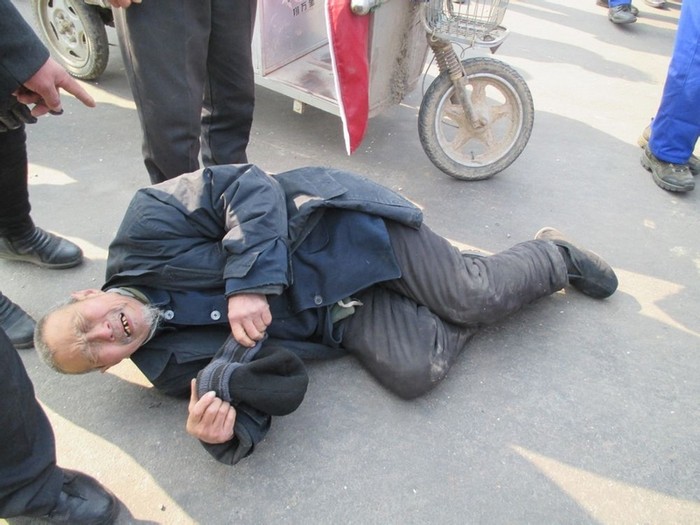 Крестьянин, пострадавший от рук охранников завода во время акции протеста. Провинция Хэбэй. Февраль 2014 года. Фото с epochtimes.com