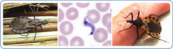 Поцелуйный клоп и паразит Trypanosoma cruzi (в центре). Фото: Centers for Disease Control and Prevention