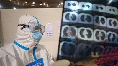 Врач смотрит на компьютерную томографию пациента во временной больнице в Ухане, Китай, 5 марта 2020 года. STR / AFP через Getty Images