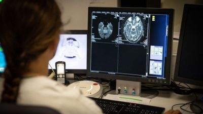 Сканирование мозга 77-летнего пациента с признаками инсульта. BSIP/Education Images/Universal Images Group via Getty Images