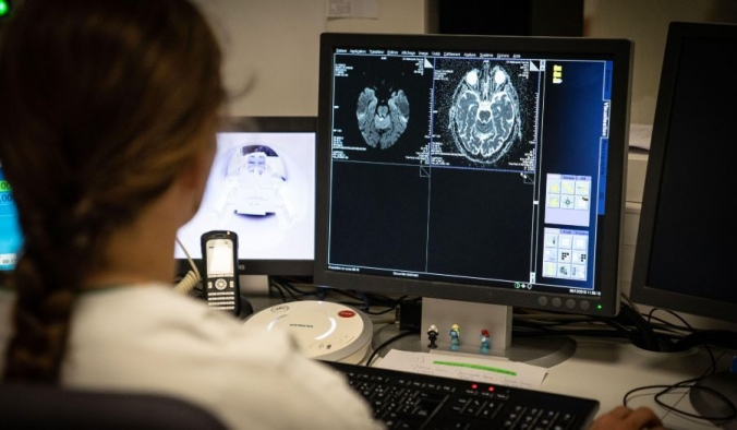 Сканирование мозга 77-летнего пациента с признаками инсульта. BSIP/Education Images/Universal Images Group via Getty Images