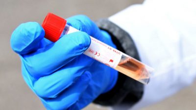 В Лас-Вегасе, штат Невада, на испытательной станции UNLV Medicine в апреле 2020 г. показана пробирка COVID-19.  Ethan Miller/Getty Images