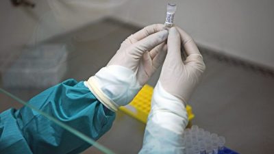 Сотрудник лаборатории Fiocruz держит образец слизи для проверки на COVID-19, 11 марта 2020 года CARL DE SOUZA/AFP via Getty Images