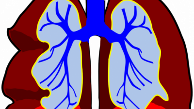 Clker-Free-Vector-Images/pixabay.com/Pixabay License