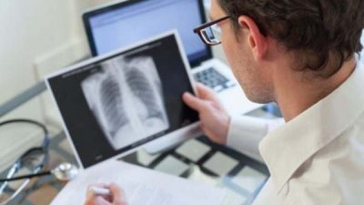 В ситуации, когда кашель длится более двух недель, врач предлагает сделать рентген грудной клетки. (Изображение: Anyaberkut via Dreamstime)