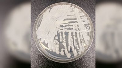 Штамм Candida auris, культивированный в чашке Петри в лаборатории CDC. Фото: Shawn Lockhart/Centers for Disease Control 