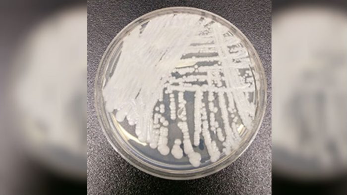 Штамм Candida auris, культивированный в чашке Петри в лаборатории CDC. Фото: Shawn Lockhart/Centers for Disease Control 