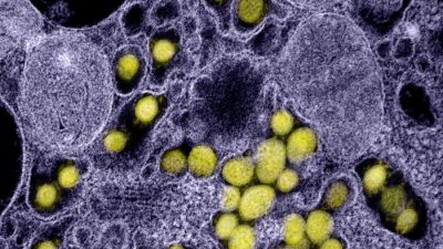 На просвечивающем электронном микрографе показаны частицы вируса SARS-CoV-2, выделенные от пациента. (NIAID)