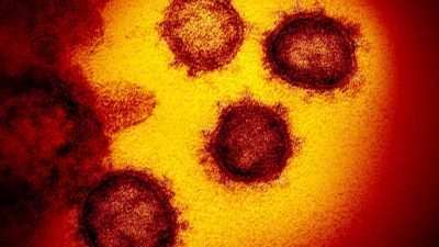 Коронавирус SARS-CoV-2, выделенный от пациента в США.Фото: Niaid-Rml/ZUMA Wire/dpa

