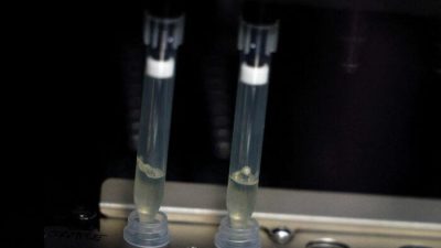 Образцы в подозреваемых случаев оспы обезьян для тестирования в лаборатории микробиологии в больнице Ла-Пас в Мадриде, Испания, 1 июня 2022 года. Фото: Susana Vera/Reuters
