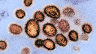 Изображение SARS-CoV-2, вируса, вызывающего заболевание COVID-19. Фото: NIAID-RML