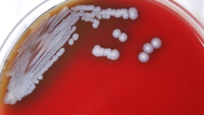 Пластина Петри, содержащая множество колоний грамотрицательных бактерий Burkholderia pseudomallei. (Dr. Todd Parker, Audra Marsh/CDC via AP)
