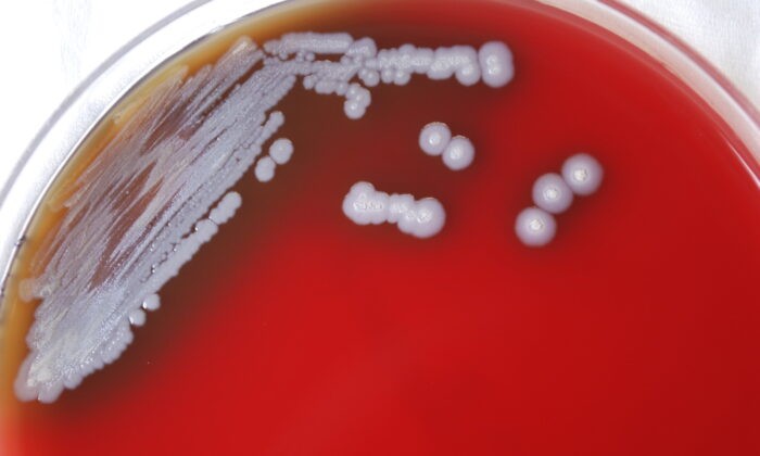 Пластина Петри, содержащая множество колоний грамотрицательных бактерий Burkholderia pseudomallei. (Dr. Todd Parker, Audra Marsh/CDC via AP)
