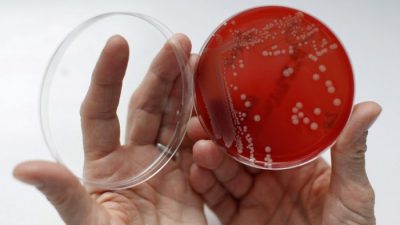 Штамм бактерий MRSA (Метициллинрезистентный золотистый стафилококк) в чашке Петри с агаровым желе. MRSA — это устойчивая к лекарствам «супербактерия», которая может вызывать смертельно опасные инфекции. (REUTERS/Fabrizio Bensch)