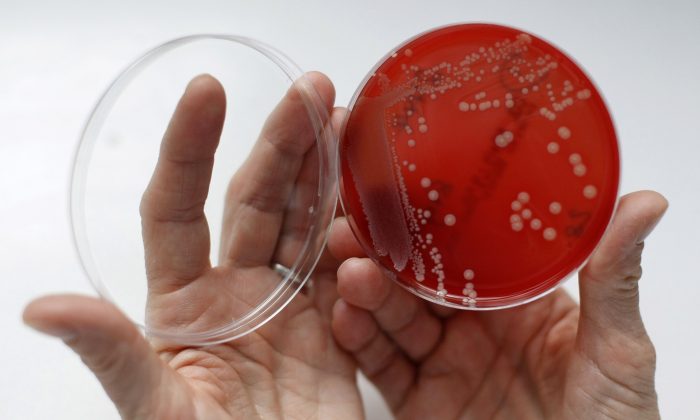 Штамм бактерий MRSA (Метициллинрезистентный золотистый стафилококк) в чашке Петри с агаровым желе. MRSA — это устойчивая к лекарствам «супербактерия», которая может вызывать смертельно опасные инфекции. (REUTERS/Fabrizio Bensch)